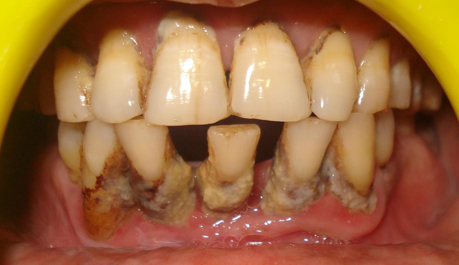 family dentist ahmedabad , bad breadth treatment, teeth ... diagram lower back 